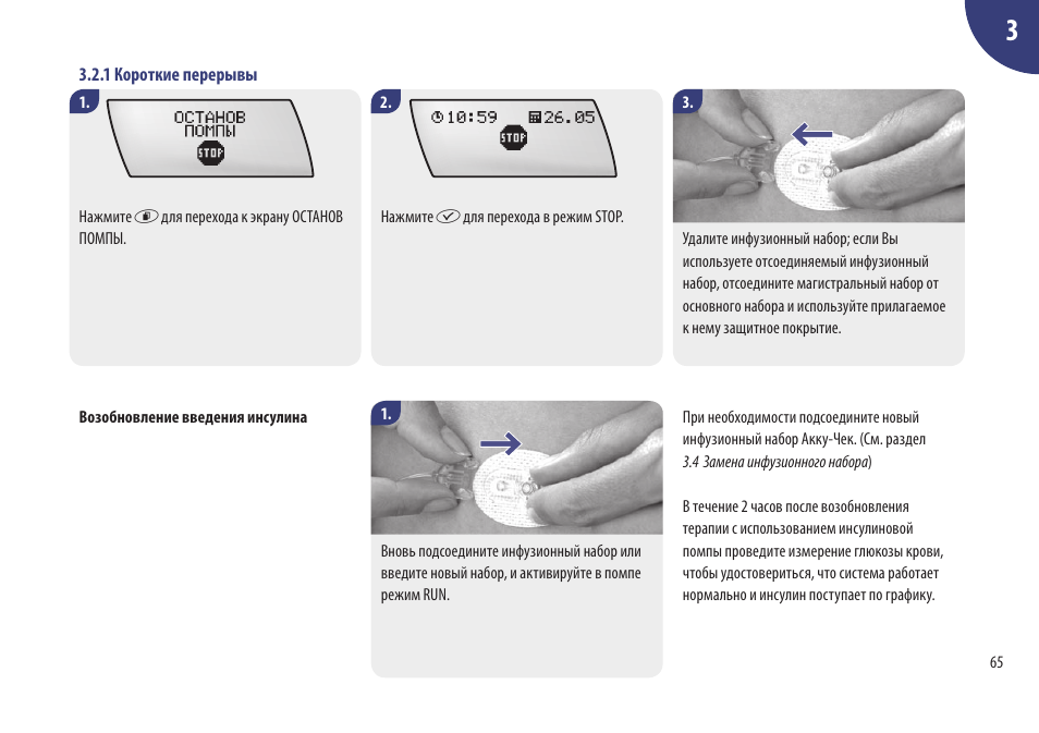 Check owners manual перевод. Инфузионный набор Акку чек. Ошибки помпы Акку чек комбо. Инсулиновая помпа Акку чек Размеры. Акку чек спирит комбо инструкция.