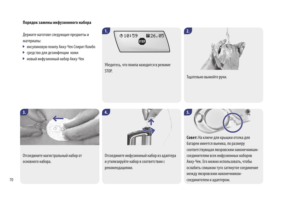Видео инструкция как пользоваться. Инфузионная система для помпы Акку чек комбо. Инфузионный набор для инсулиновой помпы Акку чек комбо. Инфузионный набор для инсулиновой помпы Акку чек спирит комбо. Смена инфузионного набора Акку чек комбо.
