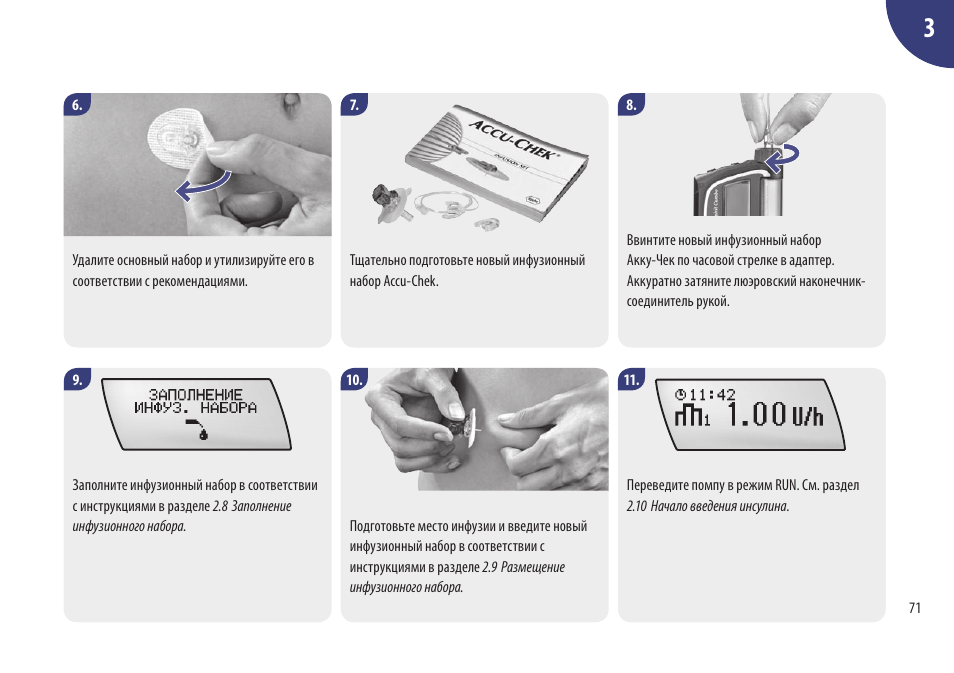 Check owners manual перевод. Сервисный набор к помпе Акку чек комбо. Инфузионный набор Акку чек. Стартовый набор Аккучек спирит комбо. Акку чек спирит комбо инструкция.