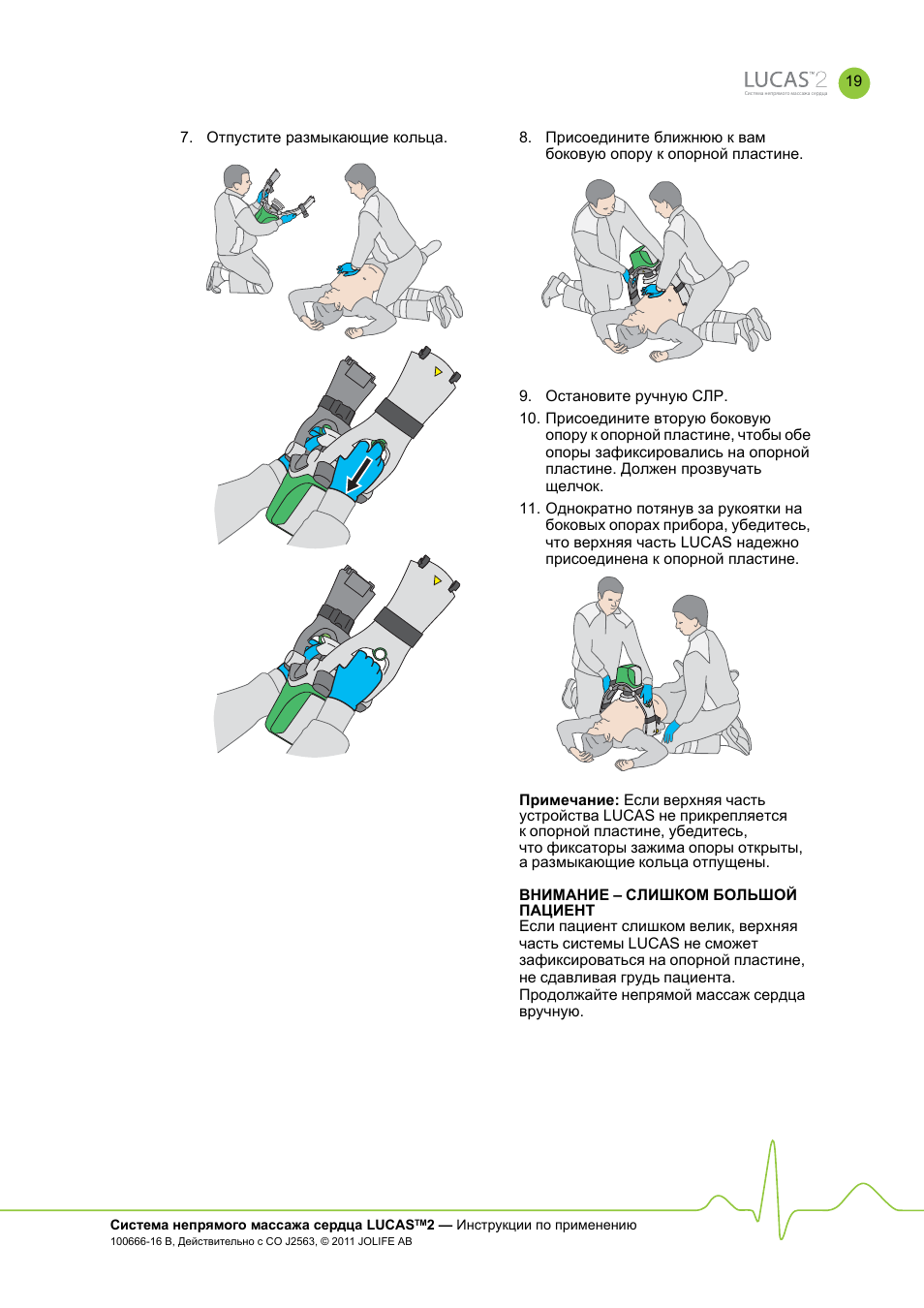Инструкцию здоровья. Массаж сердце инструкция по применению. Сиквентиал 2 инструкция.
