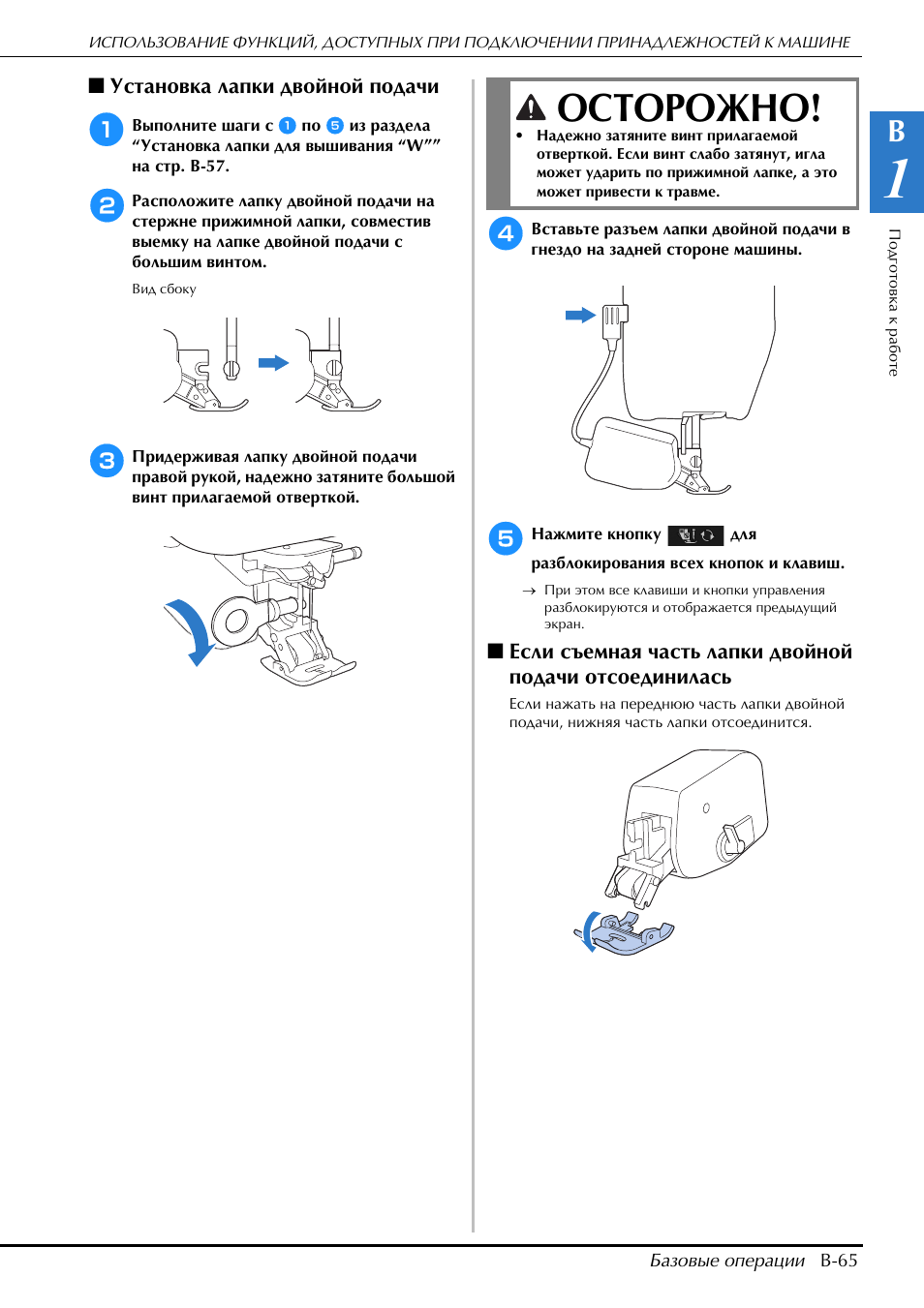 Подай инструкцию. Brother Innov-is v5 мануал. Кака правильно установить лапы БФТ.